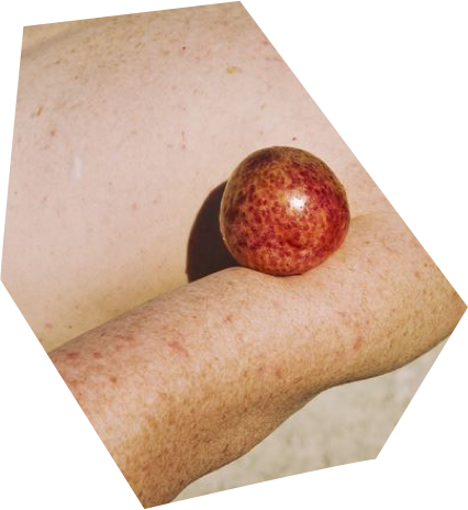 apple-arm